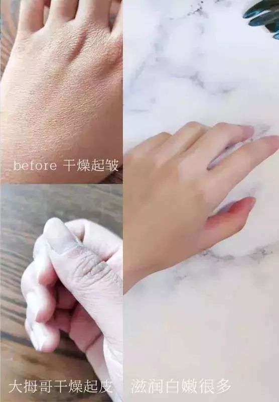 手纹深粗糙是不是比较好,手纹深粗糙干燥怎么办