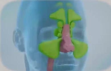 北京人民医院王旻做鼻炎手术,鼻窦炎怎么治疗协和