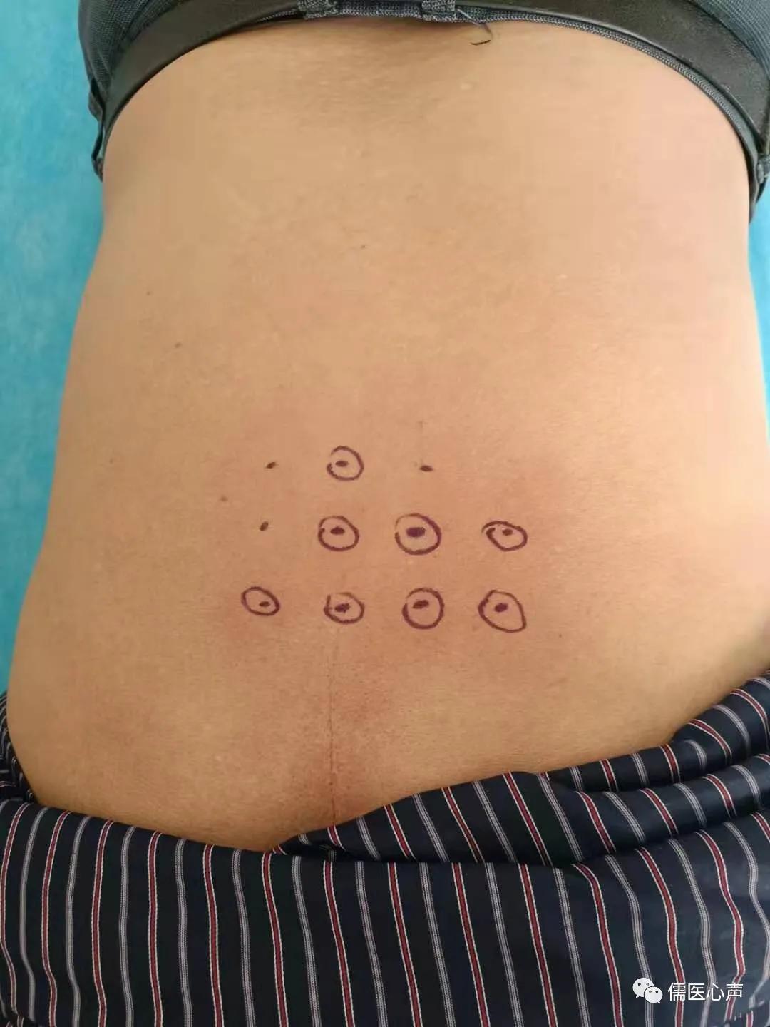 两侧肋骨痛并伴有胸闷气短,胸闷心慌胸疼乏力怎么回事