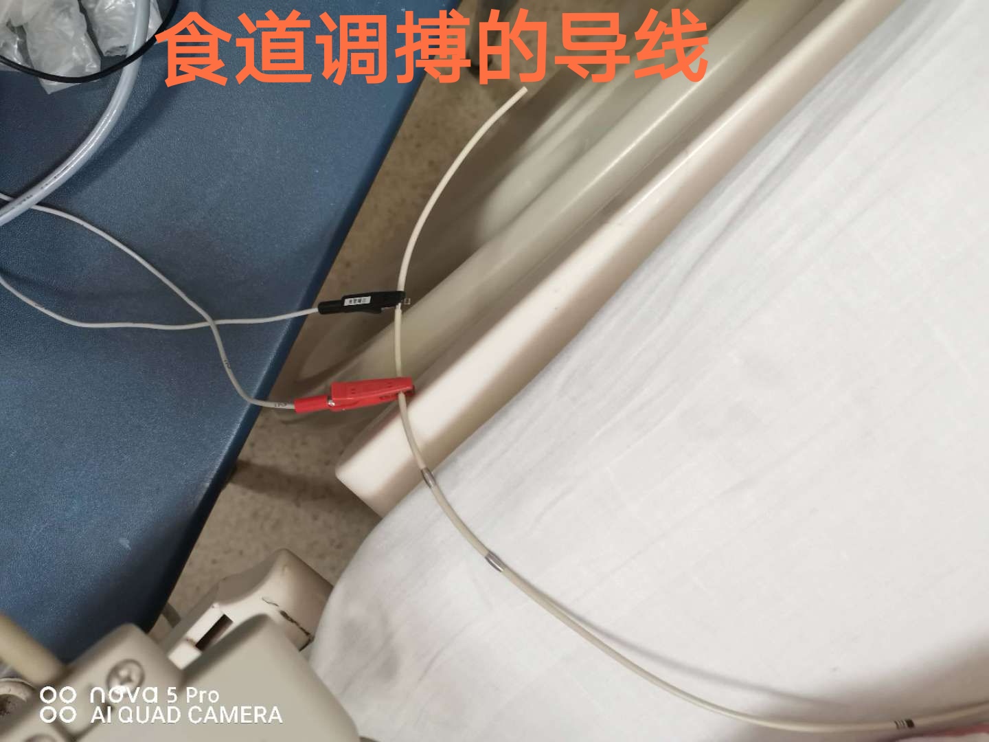 孕妇心动过速外加有点心肌缺血,怀孕心电图窦性心动过速心慌胸闷