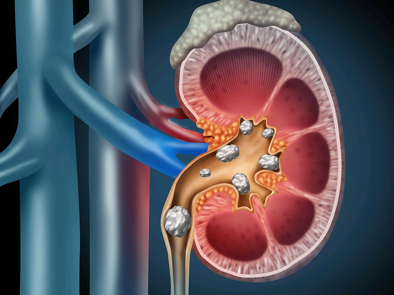 尿液怎么产生的,尿液是怎么产生的