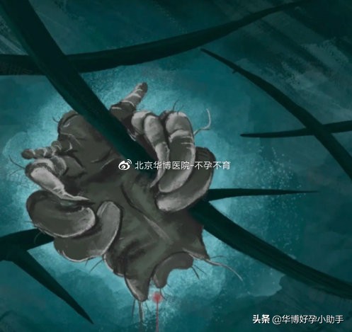 皮肤瘙痒起疙瘩抓出现血斑,皮疹痒挠多了有淤血