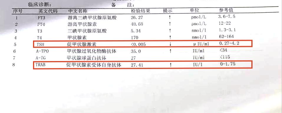 桥本甲亢和结节,桥本甲状腺炎出现轻微甲亢
