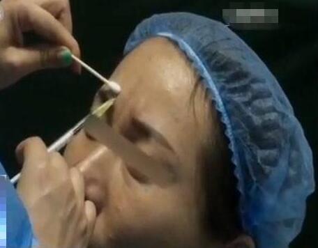 80岁老伯和26岁乖乖女都感染上梅毒，原因令人费解