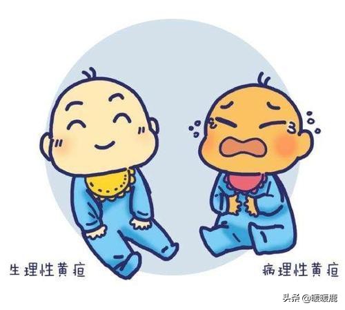 新生儿生理性黄疸和病理性黄疸的区别，黄疸必须照光吗，晒太阳呢