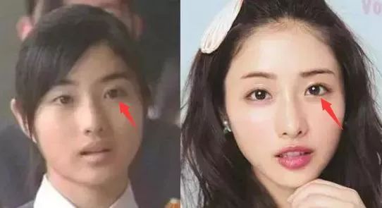 日本整容真的很好吗,日本整容vs韩国整容图片对比