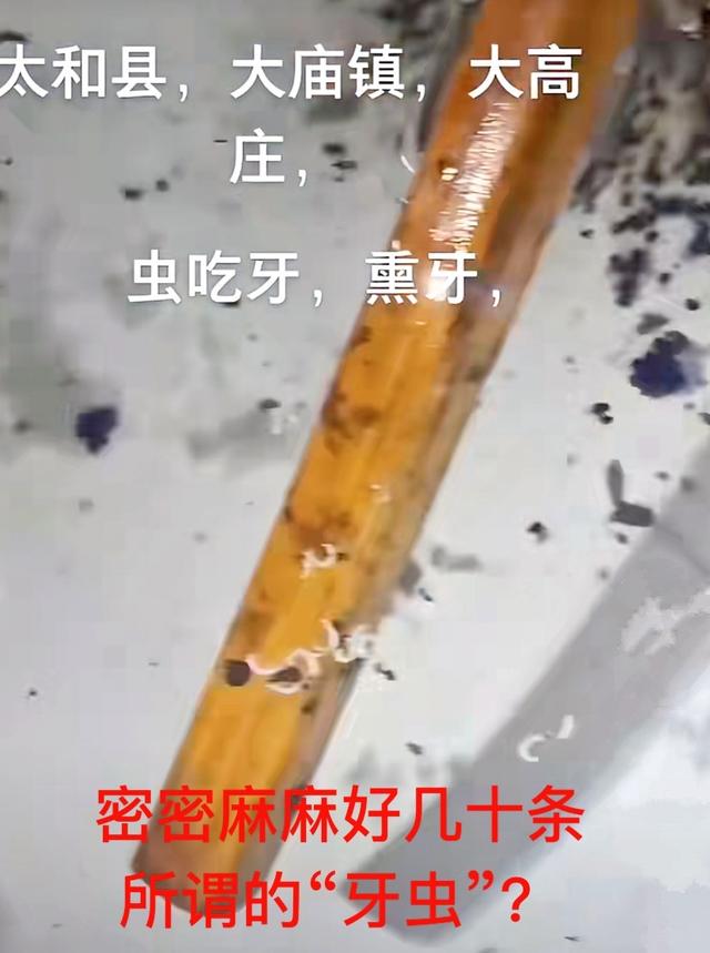 女儿蛀牙疼哭,女儿蛀牙痛