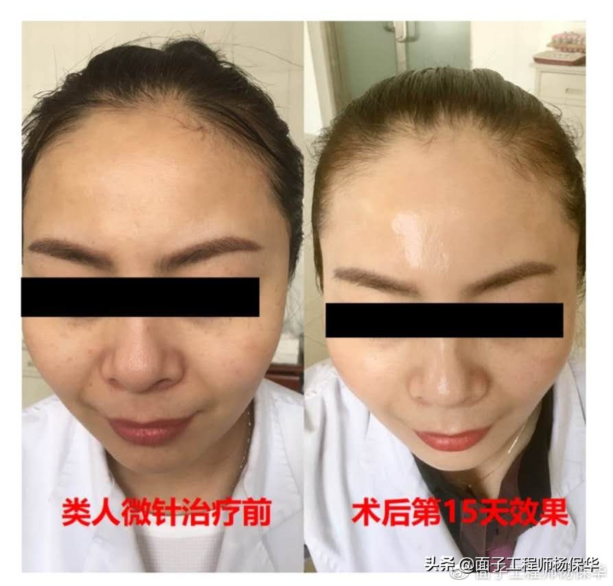 孕妇胶原蛋白流失如何补充,维c可以帮你补充流失的胶原蛋白