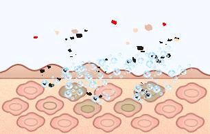 孩子长痘痘抹什么药膏保湿,小孩长痘痘怎么治疗最好8岁
