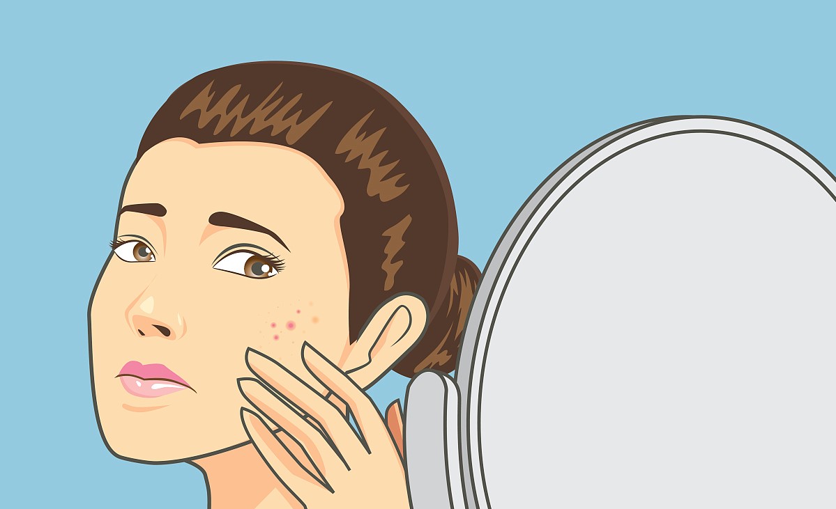 玫瑰疱疹是什么引起的,玫瑰痤疮属于什么类型皮肤病