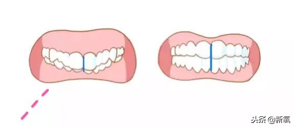 辛芷蕾是苦相女生吗,辛芷蕾气质怎么养成