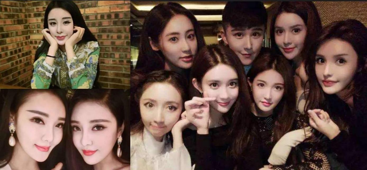 割双眼皮是种什么体验,割双眼皮什么样子才是增生