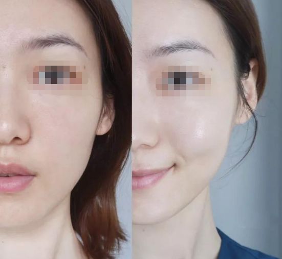 赵露思推荐补水保湿,赵露思推荐水感保湿焕颜面霜