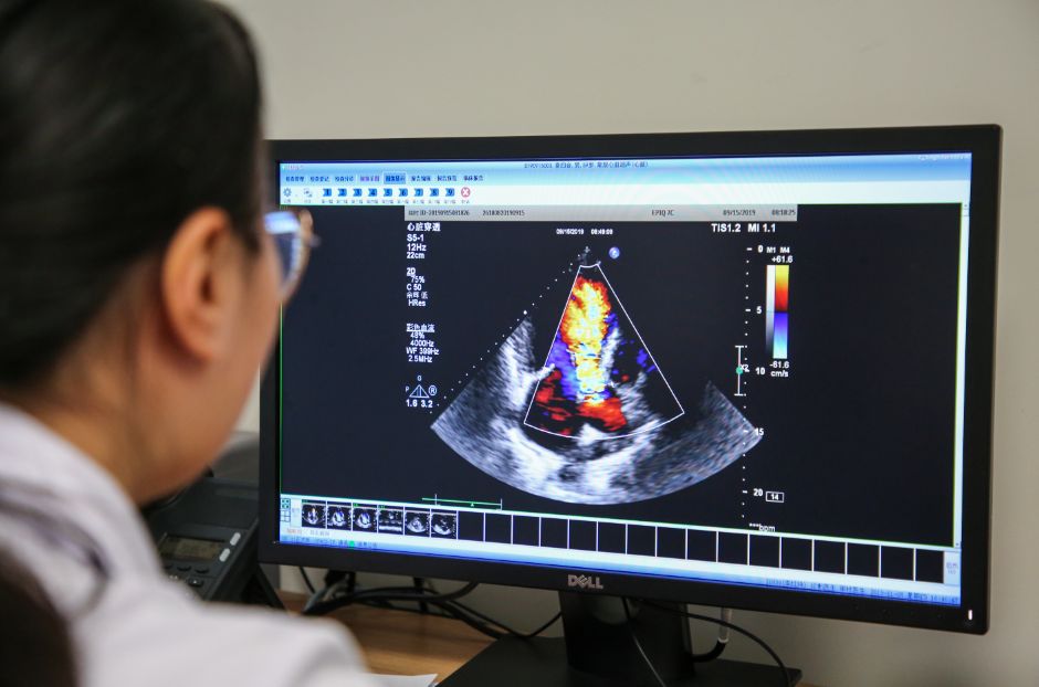 日照心脏瓣膜手术,瓣膜引起的心衰手术后可以康复吗