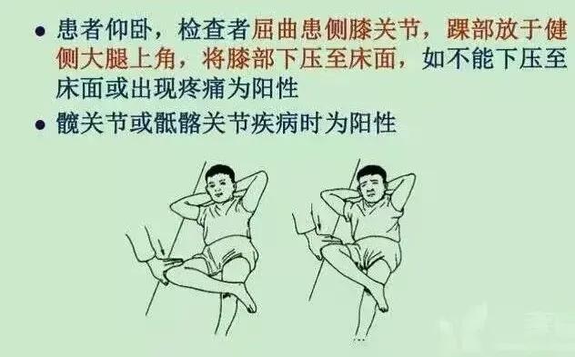 股骨头坏死和腰间盘突出症状区别,椎间盘突出和股骨头坏死症状区别