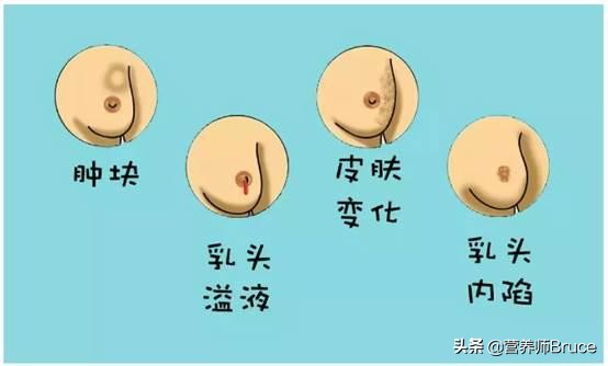 什么人容易乳腺癌,什么人易得乳腺癌