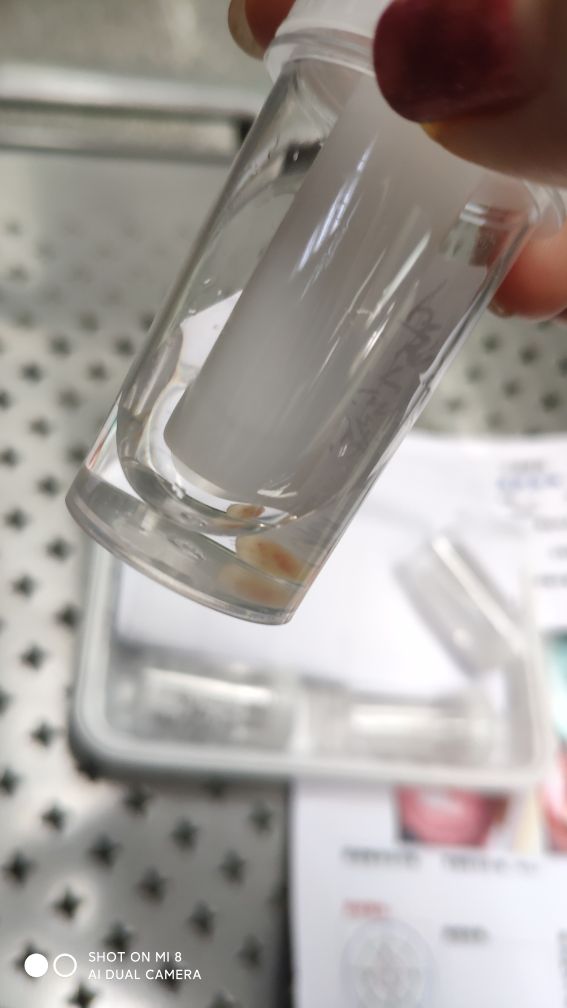 人生第一次做妇检,活检第一次是癌而第二次没有