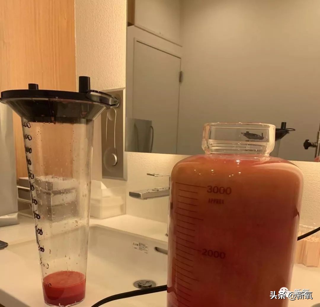 迷死氧亲身体验，我在日本吸掉了一桶脂肪和半张脸