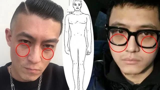 罗志祥为什么总是黑眼圈,罗志祥的黑眼圈