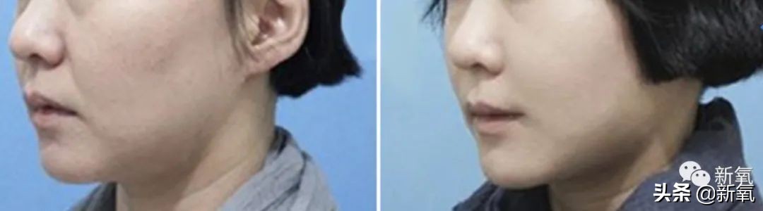 杨超越还能撑多久,杨超越遇到的真实事件