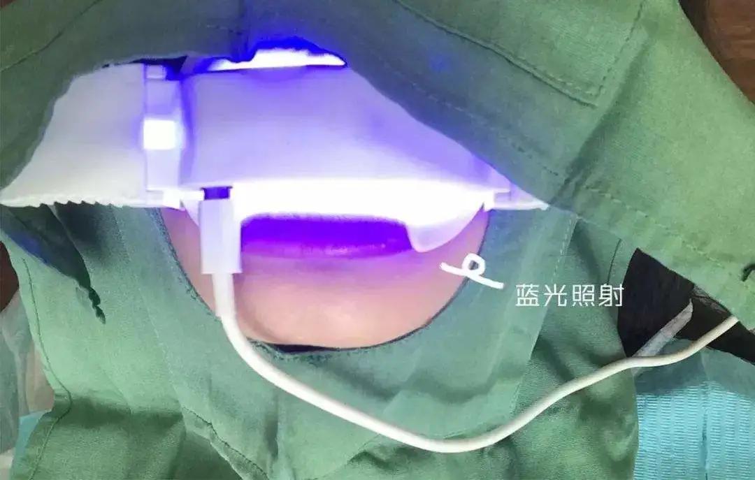 如何让牙齿变白这些方法你知道吗,口臭和牙黄用什么牙膏让牙齿变白