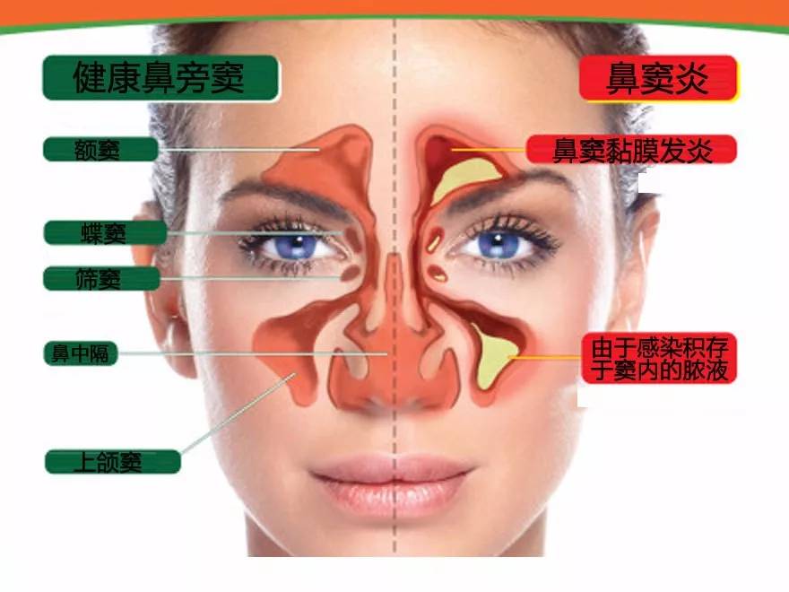 宝宝感冒十天了还流鼻涕,什么病与感冒的症状相似