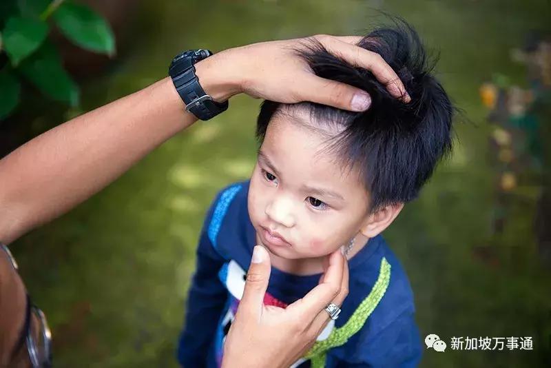 新加坡伊蚊事件,新加坡伊蚊病