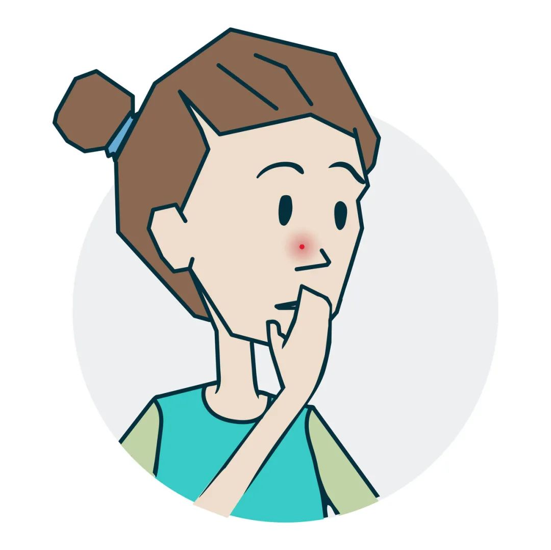 绝对不能挤的痘痘一般长什么样,哪里的痘痘不能挤