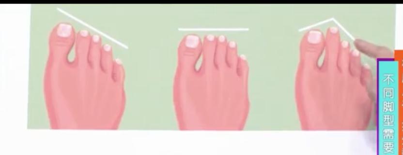 怎样选一款适合自己脚型的鞋,适合大脚骨穿的鞋测评