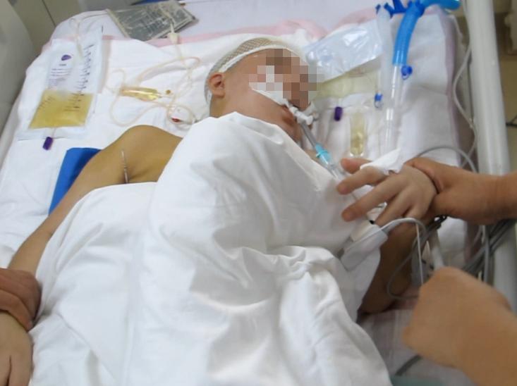 脑室有粘连脑积水有什么办法,脑动脉畸形手术后出现急性脑积水