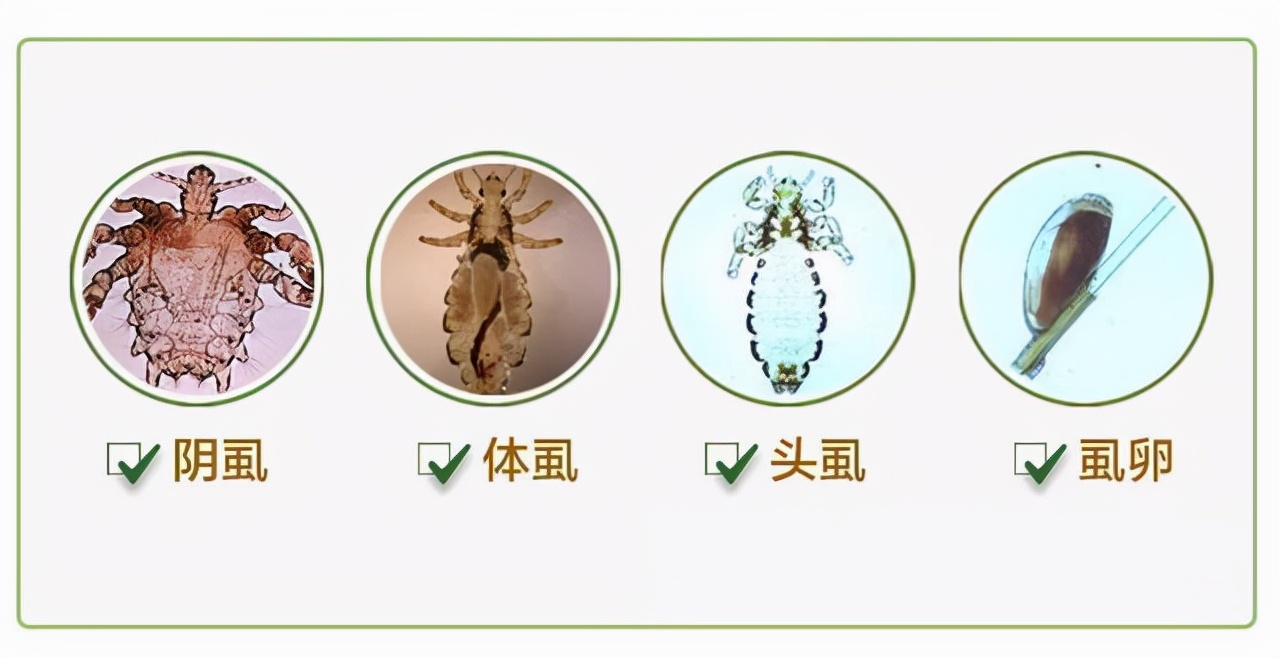 存在上亿年的虱子为何突然不见了,虱子灭绝了为什么消失不见了