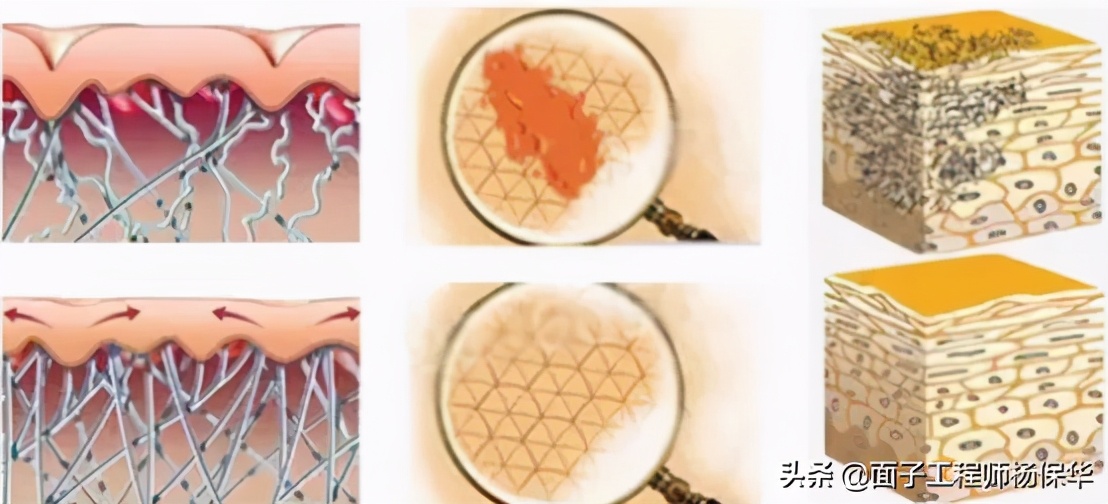 疤痕常识,关于疤痕淡化的问题