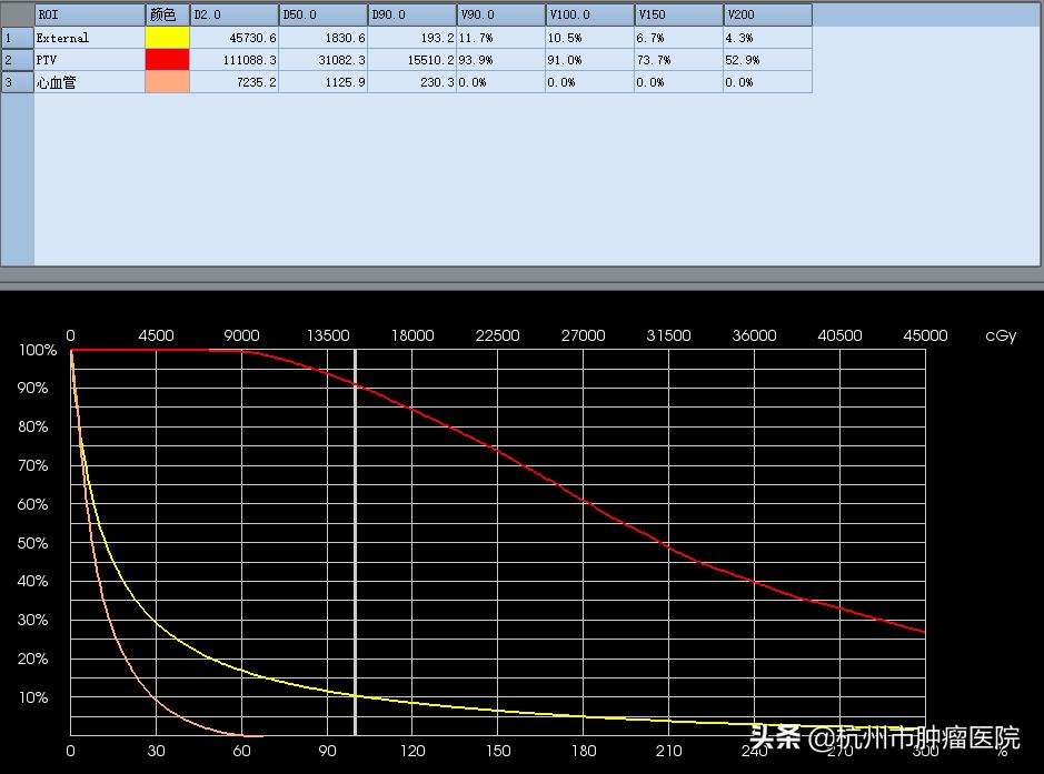肿瘤医院ct三维重建图像多少钱,医院3d打印肿瘤模型