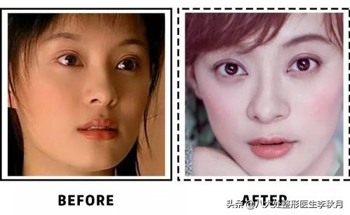 哪些男女明星双眼皮是割的,娱乐圈双眼皮男明星