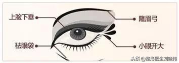 眼睛手术的坑,不要往里面跳了