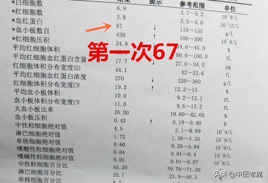 贫血五六年吃药多长时间能好,缺铁性贫血看中医能好吗