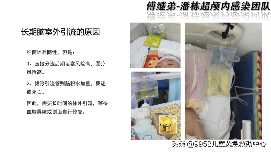 颅内感染康复治疗知识,小儿颅内感染的健康宣教