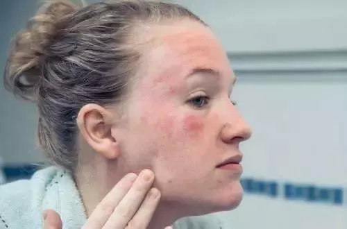 名门泽佳防晒霜的使用方法,安耐晒真假辨别颜色