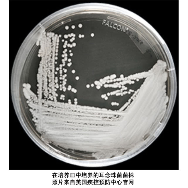 闻臭袜子会感染病毒吗,经常闻臭袜子会引起真菌感染吗