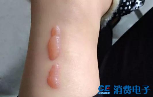 暖宝宝真实测评,暖宝宝标准