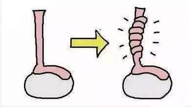 蛋疼有多疼搞笑解析,蛋疼搞笑解析