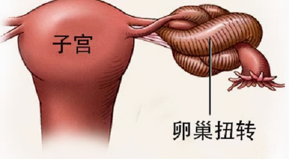 捐卵黑幕被曝光,捐卵骗局科普视频