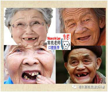 牙科医生讲义第七讲：可摘局部义齿初戴