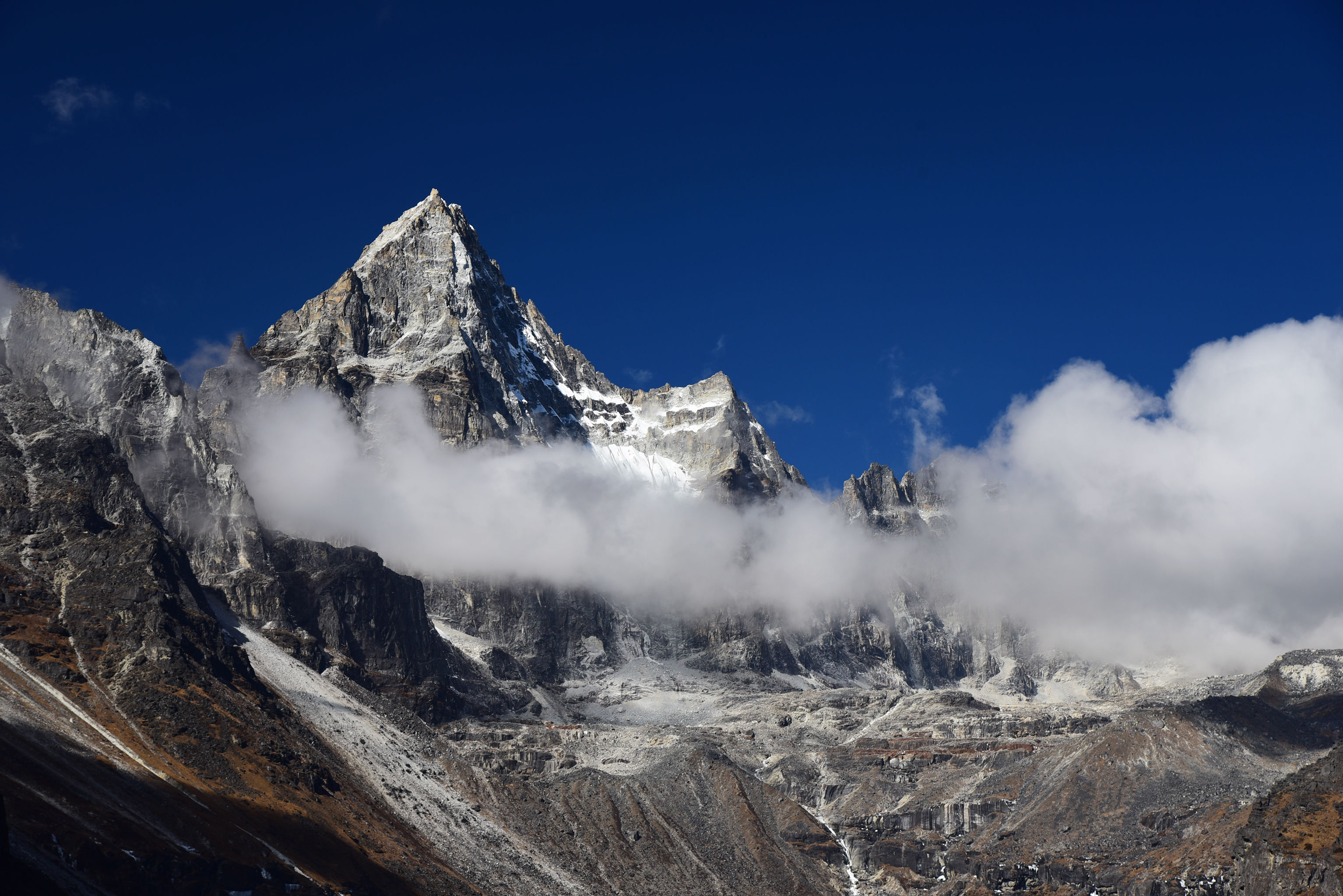 尼泊尔肾村,尼泊尔的单肾村