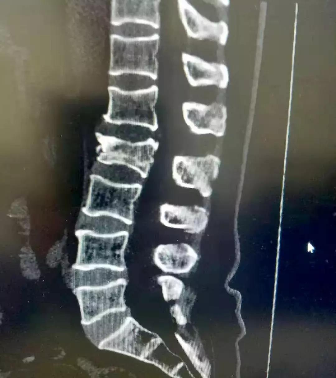 锦州发明专利,锦州实用新型专利