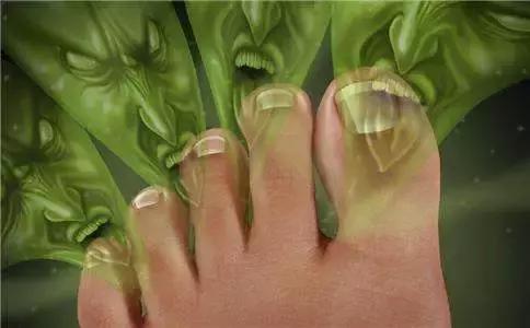 台风天脚痒,台风暴雨后当心皮肤病找上门