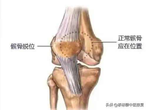 膝关节增生疼痛偏方,四神煎治膝关节疼痛