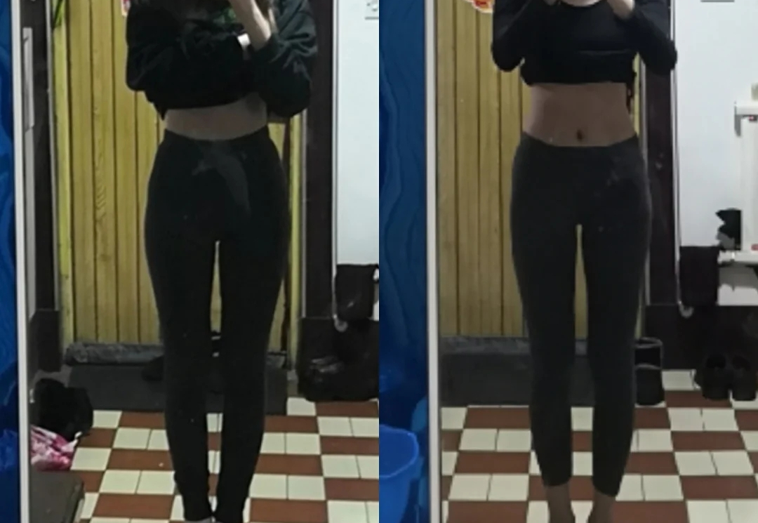 吴昕怎么改善o型腿,吴昕是怎么减掉小粗腿