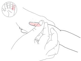 小儿推拿可以提高孩子注意力吗,小儿推拿注意力不集中