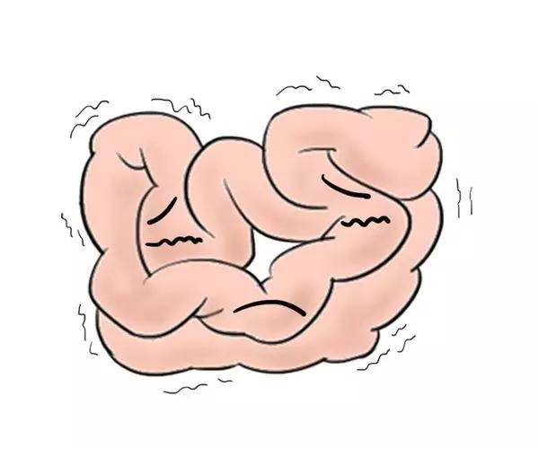 你便秘,便秘与盆底肌有关吗